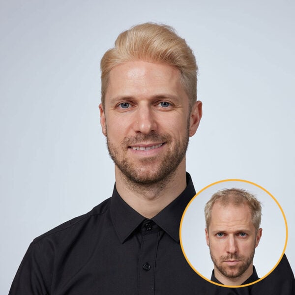 V-LOOP Men's Toupee - Natural Human Hair, Undetectable Hairpiece for Men