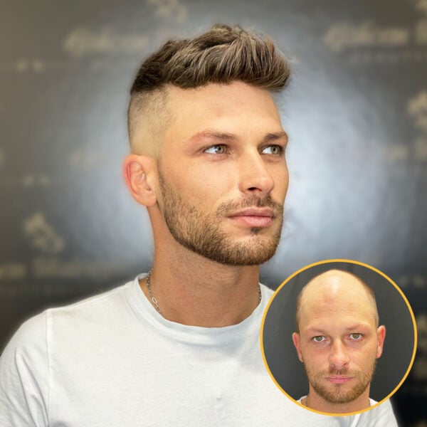 Full Swiss Lace Hair System: Ultra-Realistic Hairline for Natural Look & Comfort