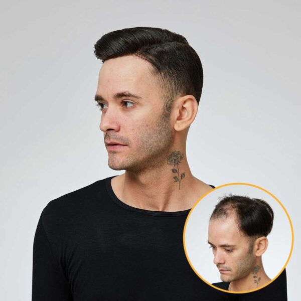 Q6 Swiss Lace Men's Toupee with PU Sides and Back – Premium Hair System for Men