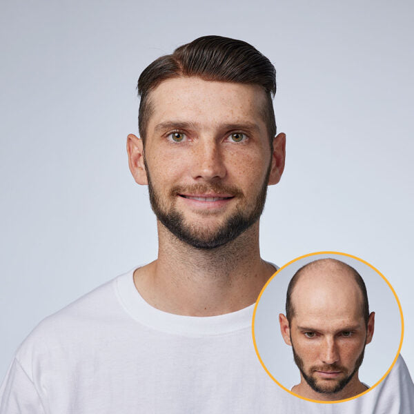 Men's Swiss Lace Toupee with PU Sides and Back – Natural Hair System for Full Coverage