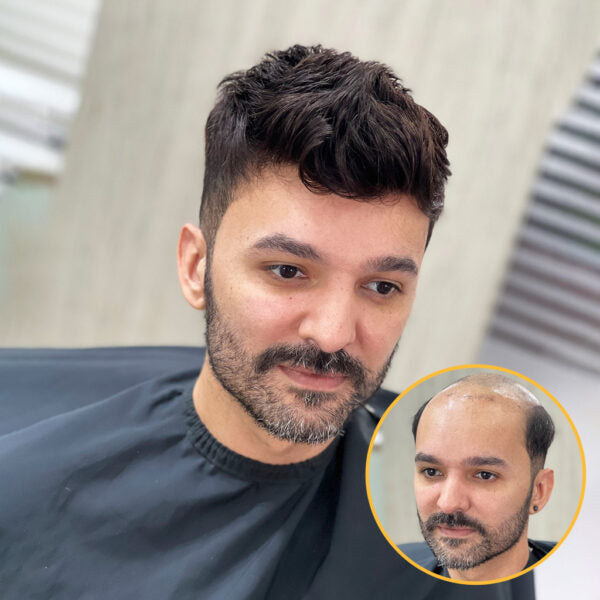 AUSTRALIA : Men's Lace Hair System With PU Perimeter Wholesale