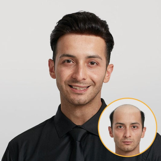 HS25-V : 0.03mm Ultra Thin Skin Men's Hair Systems With V-looped Human Hair