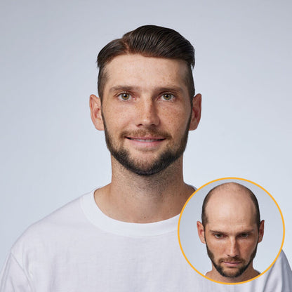 Men's Swiss Lace Toupee with PU Sides and Back – Natural Hair System for Full Coverage