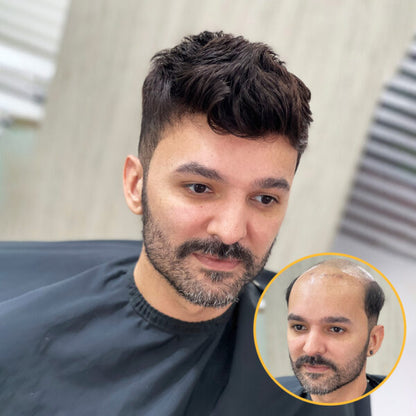 AUSTRALIA : Men's Lace Hair System With PU Perimeter Wholesale