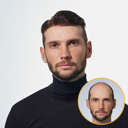 0.06mm Thin Skin Toupee Wholesale with 90% Density